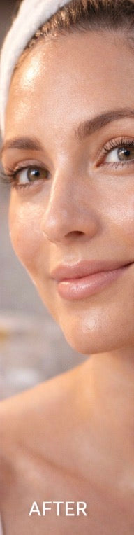 MOSSA Glow Cocktail - Crème illuminatrice Anti-Pigmentations